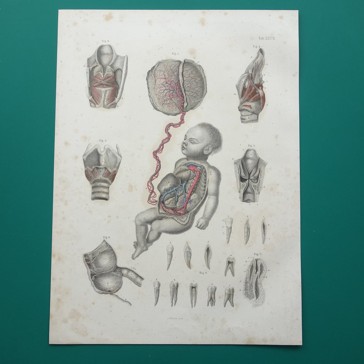 Oude anatomie print over foetale bloedsomloop 1871 Antieke prent tanden en kiezen Vintage anatomische illustratie