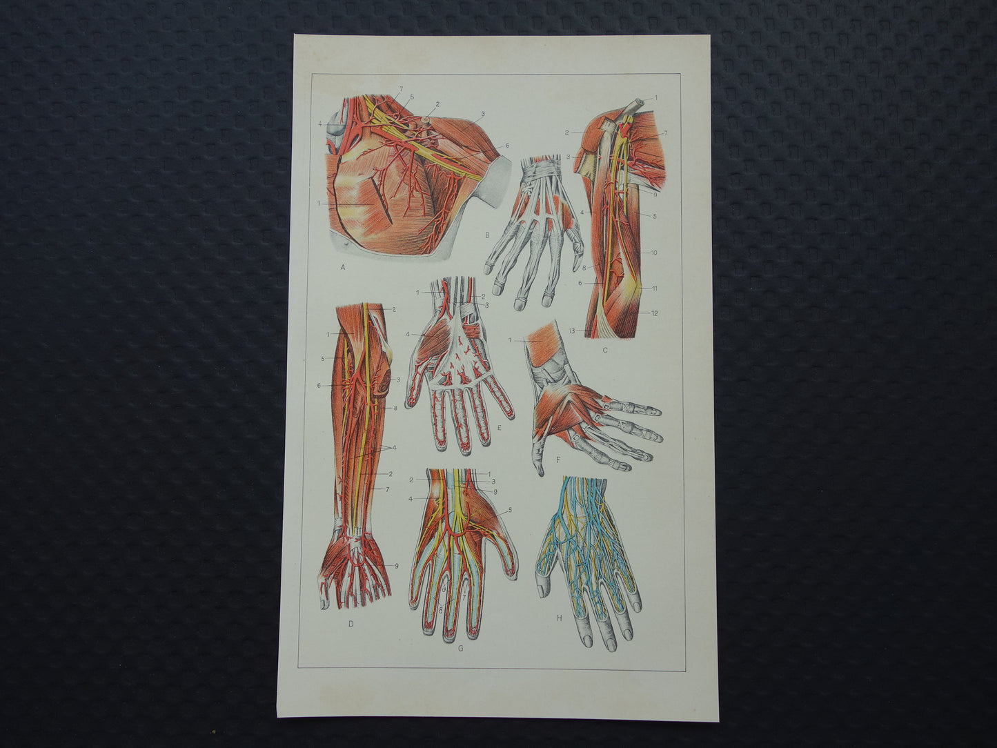 ARM HAND oude anatomie prent 1933 originele vintage Nederlandse illustratie van Armen Handen afbeeldingen prenten