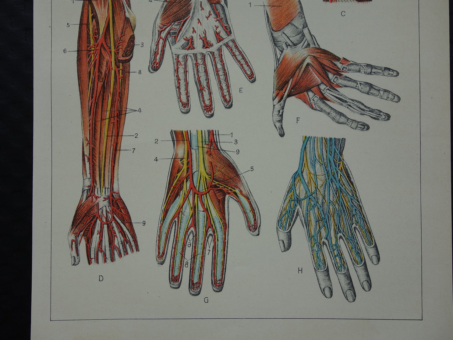ARM HAND oude anatomie prent 1933 originele vintage Nederlandse illustratie van Armen Handen afbeeldingen prenten