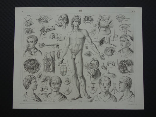Oude anatomie prent over chirurgie originele antieke print operaties instrumenten chirurg anatomische prenten
