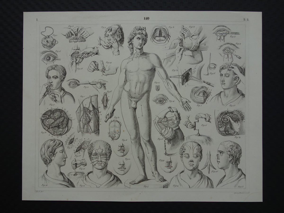 plastisch chirurgie antieke prent