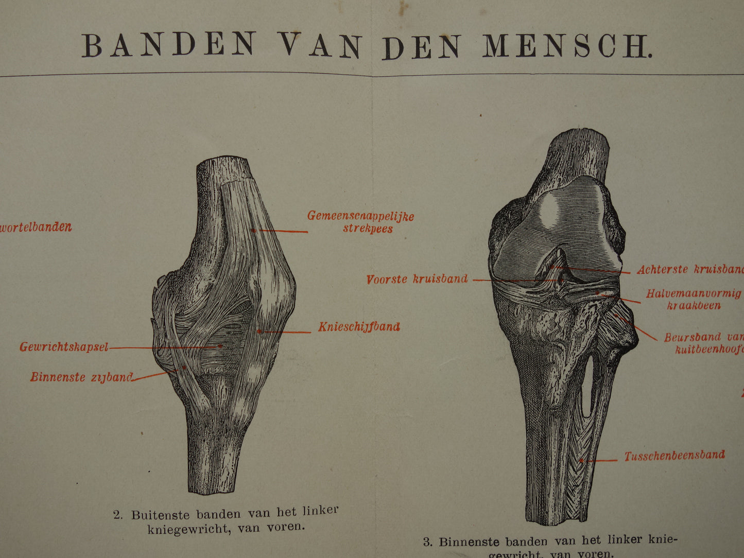Oude Anatomie Prent Ligamanten Originele antieke anatomische illustratie vintage print van banden ligament gewrichtsbanden
