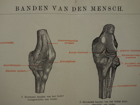 Oude Anatomie Prent Ligamanten Originele antieke anatomische illustratie vintage print van banden ligament gewrichtsbanden
