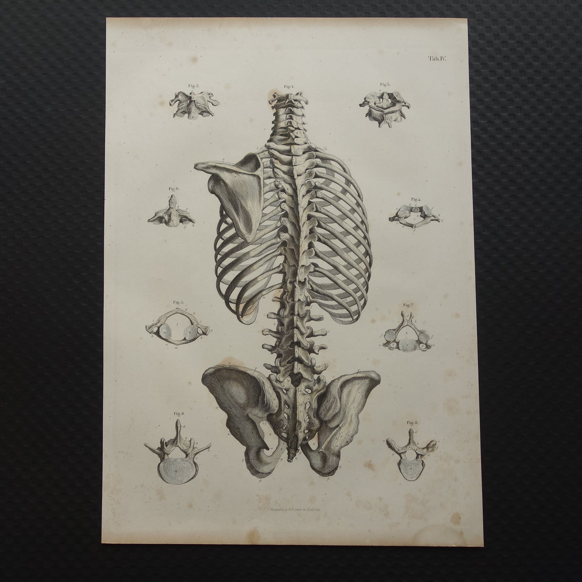 oude anatomische prenten kopen