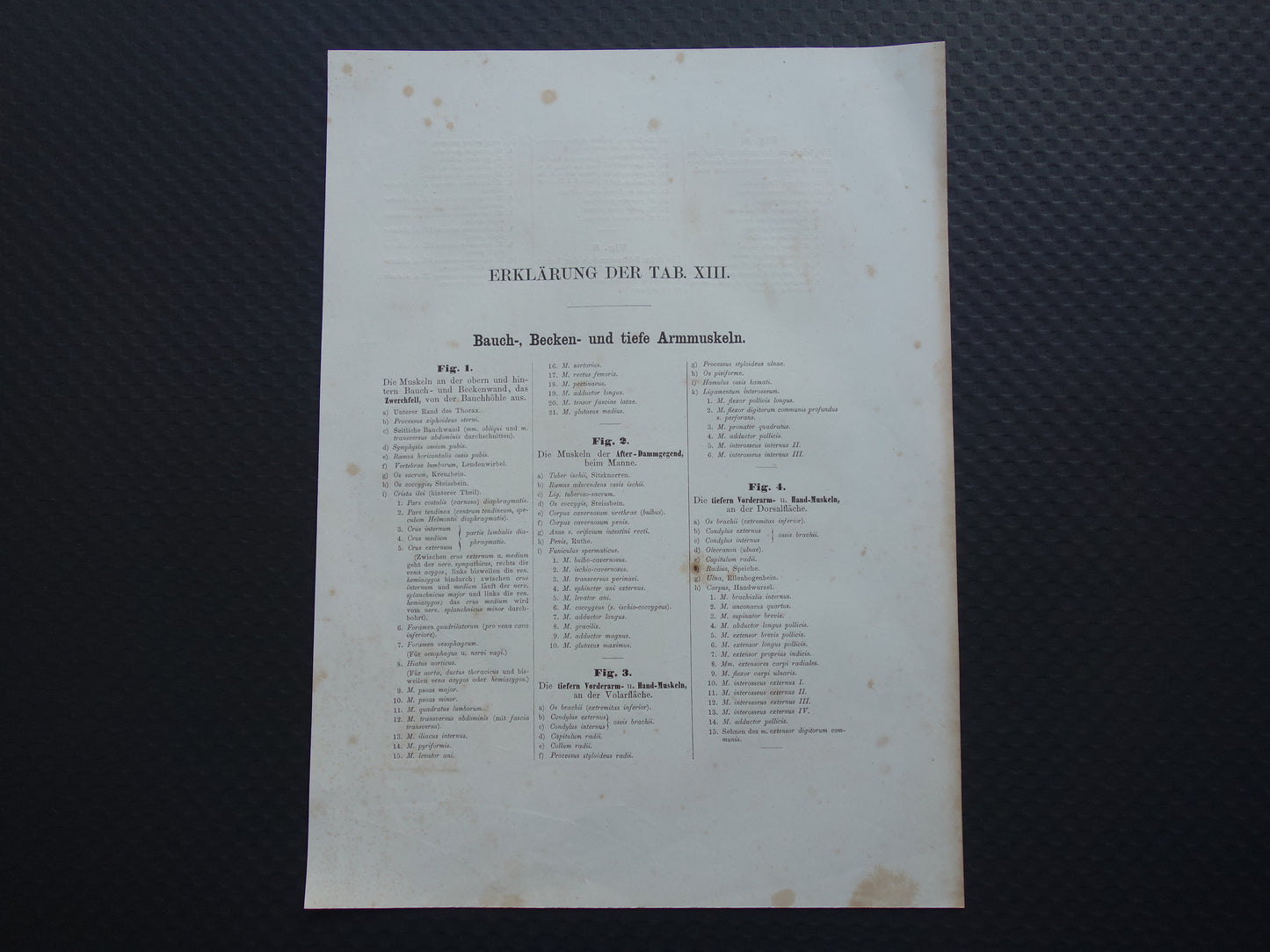 Oude anatomie print buikspieren bekkenbodemspieren 1871 Antieke prent Vintage anatomische illustratie armspieren