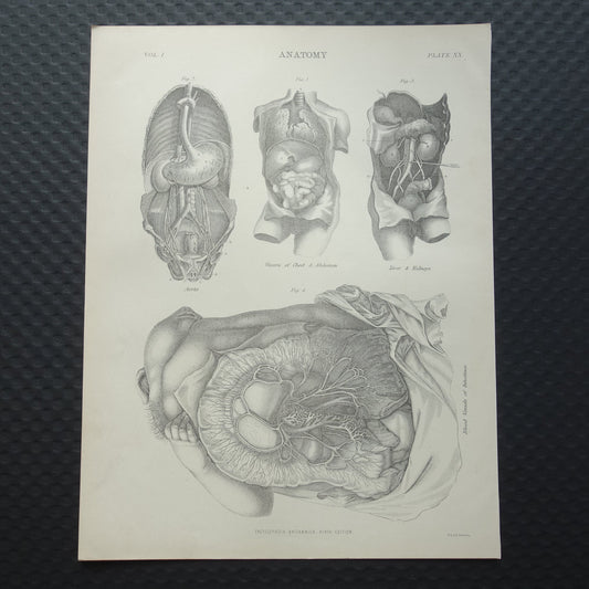 Oude Anatomie Prent 1875 Originele antieke Engelse anatomische illustratie vintage print ingewanden aorta
