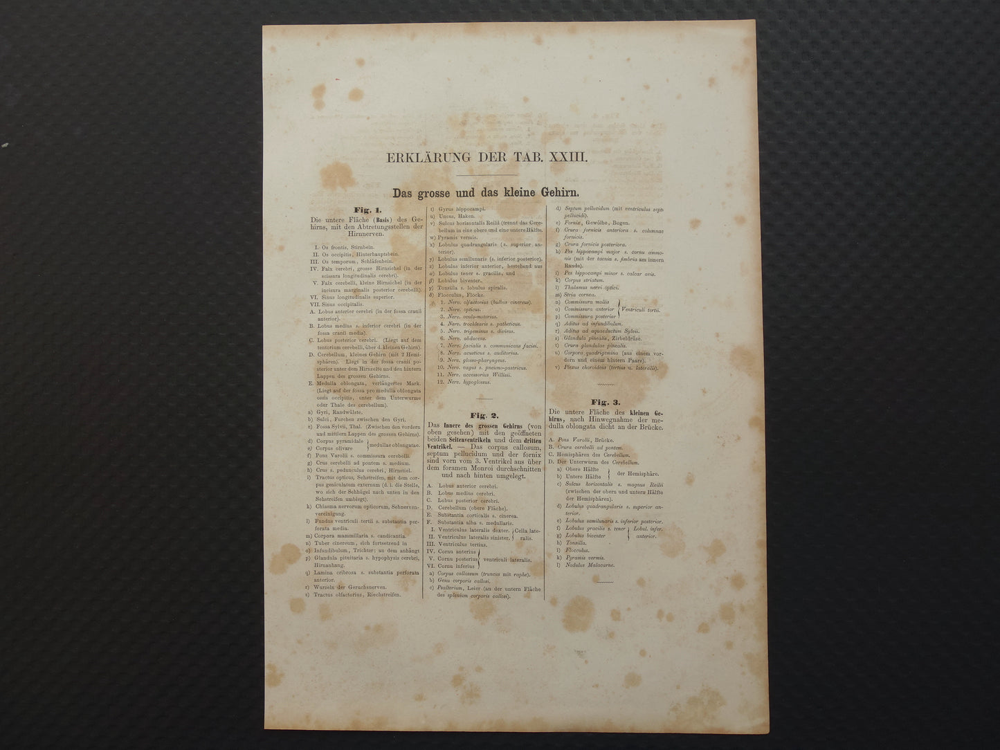 HERSENEN Oude anatomie print menselijke hersenen 1871 Antieke prent Vintage anatomische illustratie