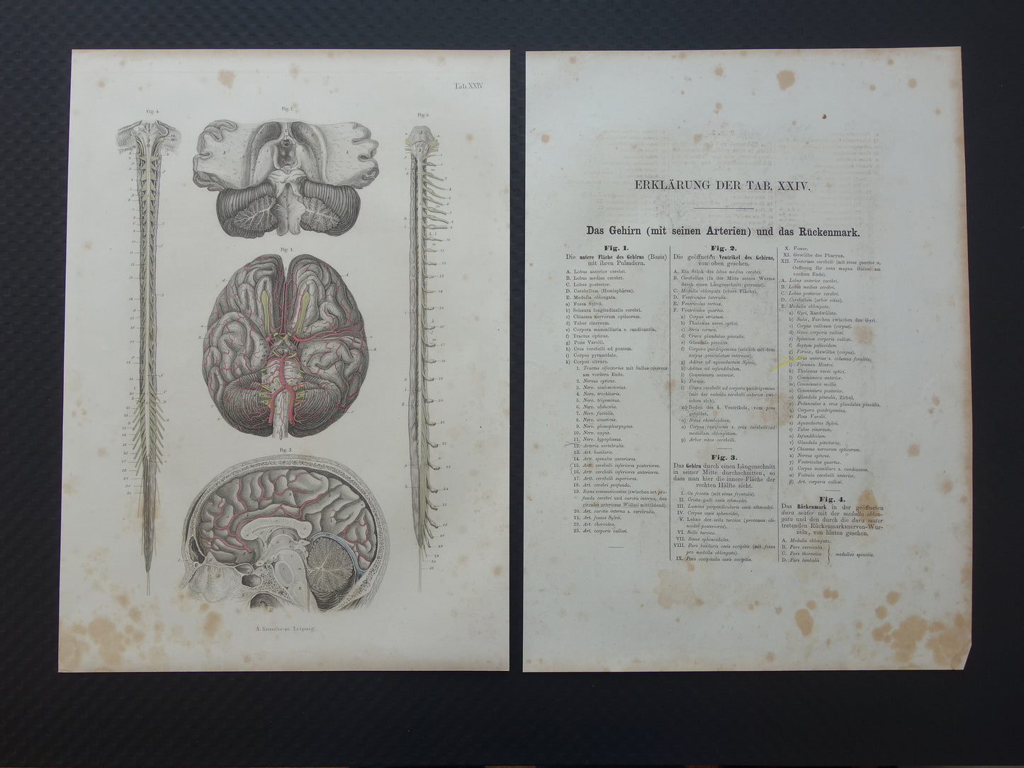 HERSENEN Oude anatomie print menselijke hersenen 1871 Antieke prent Vintage anatomische illustratie ruggenmerg