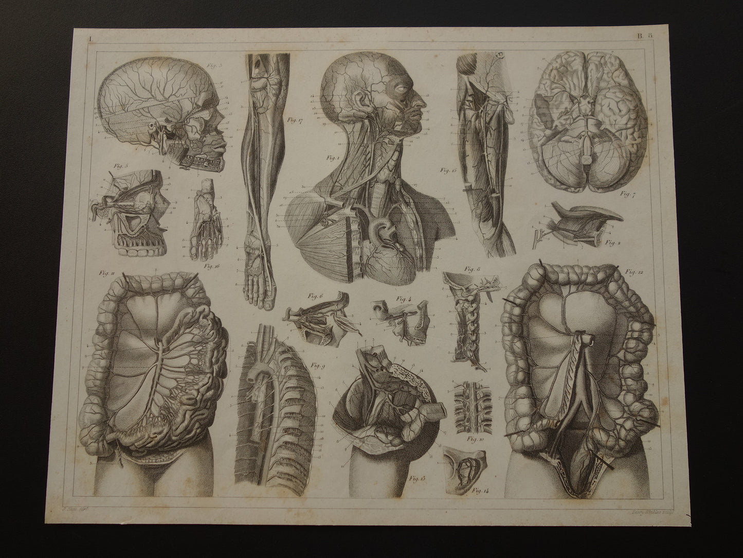 Oude Anatomie Prent Originele antieke anatomische illustratie vintage print van hersenen bloedvaten organen