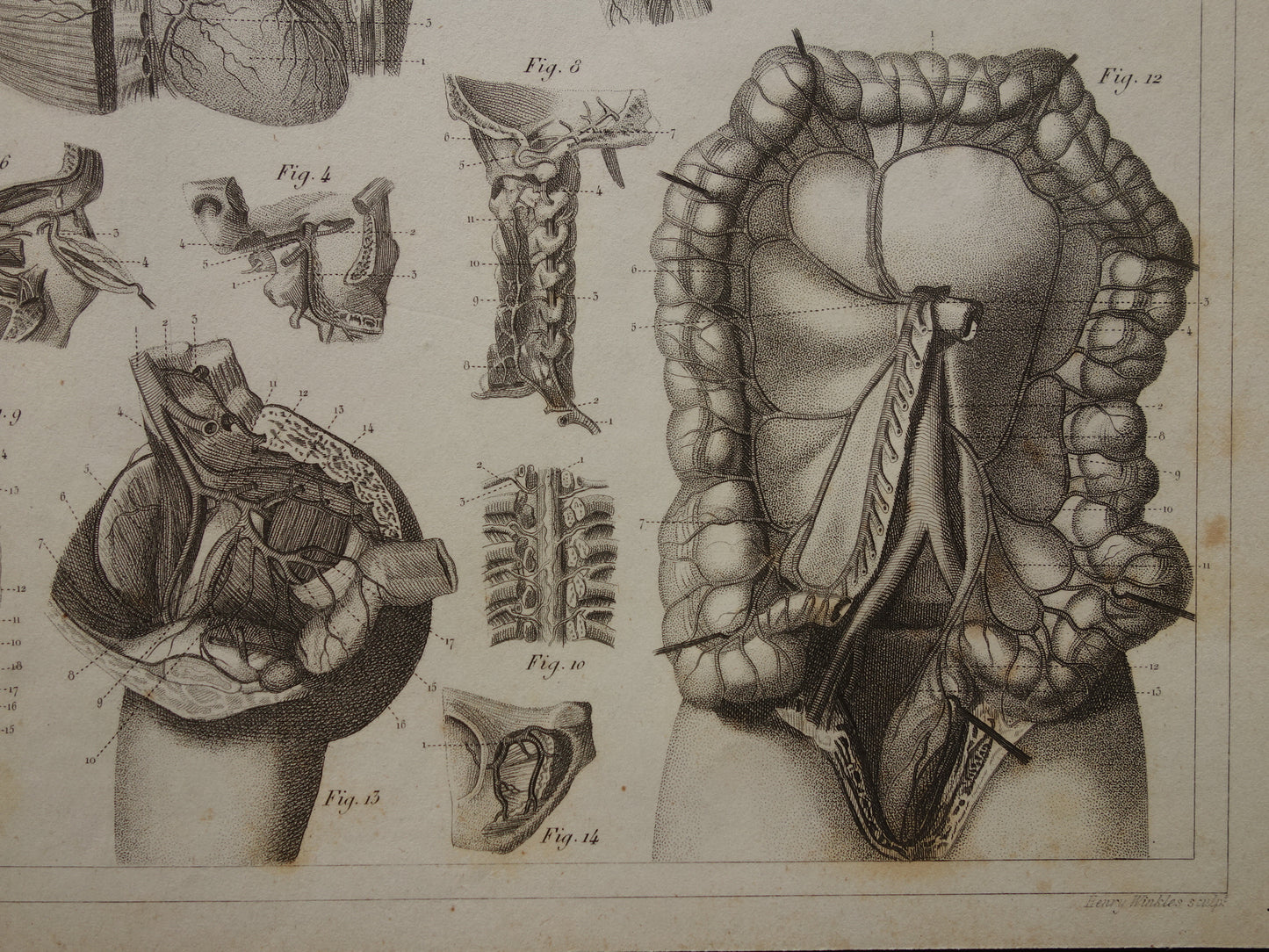 Oude Anatomie Prent Originele antieke anatomische illustratie vintage print van hersenen bloedvaten organen