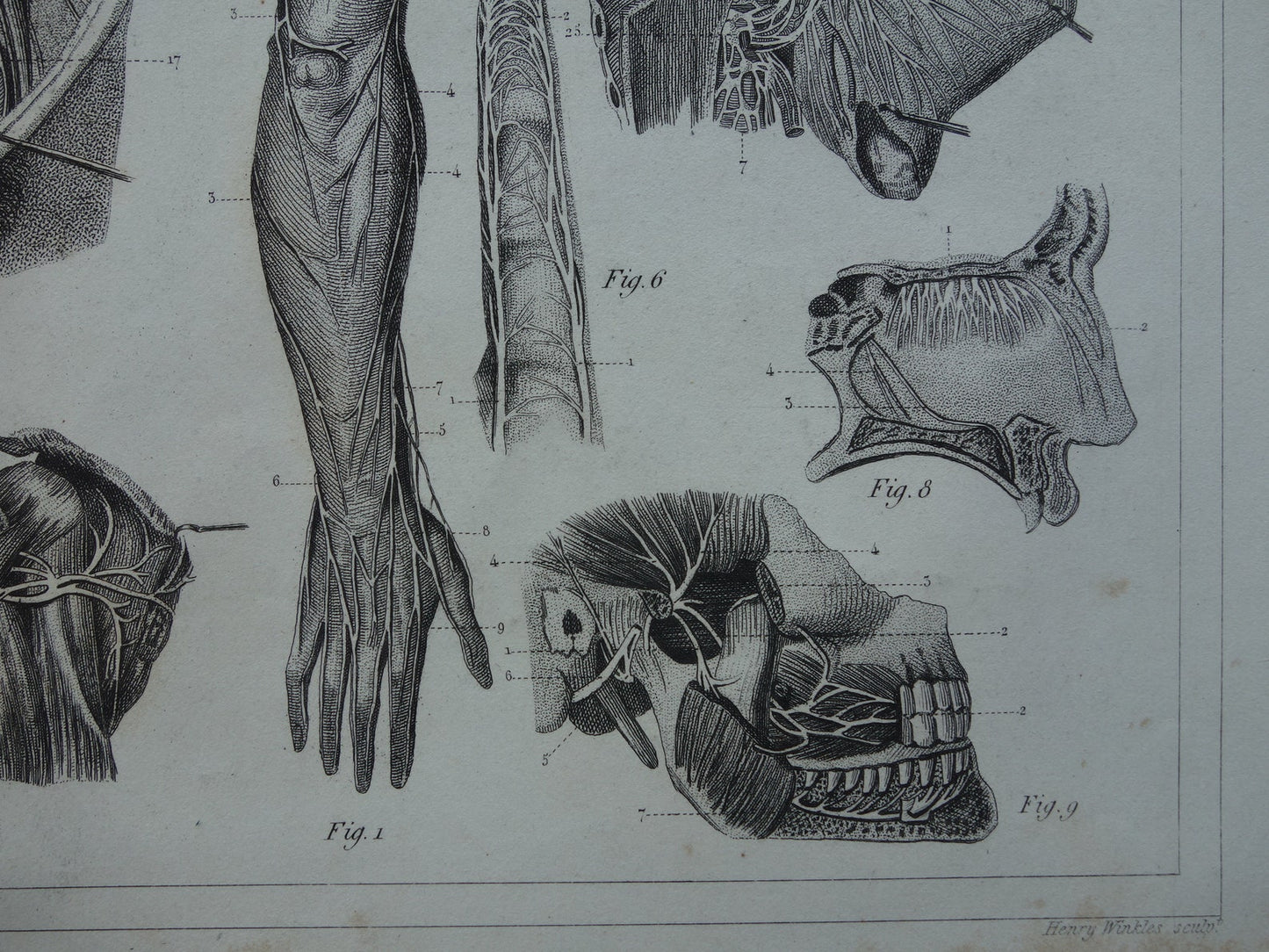 ZENUWSTELSEL Oude Anatomie Prent Zenuwen Originele antieke anatomische illustratie vintage print