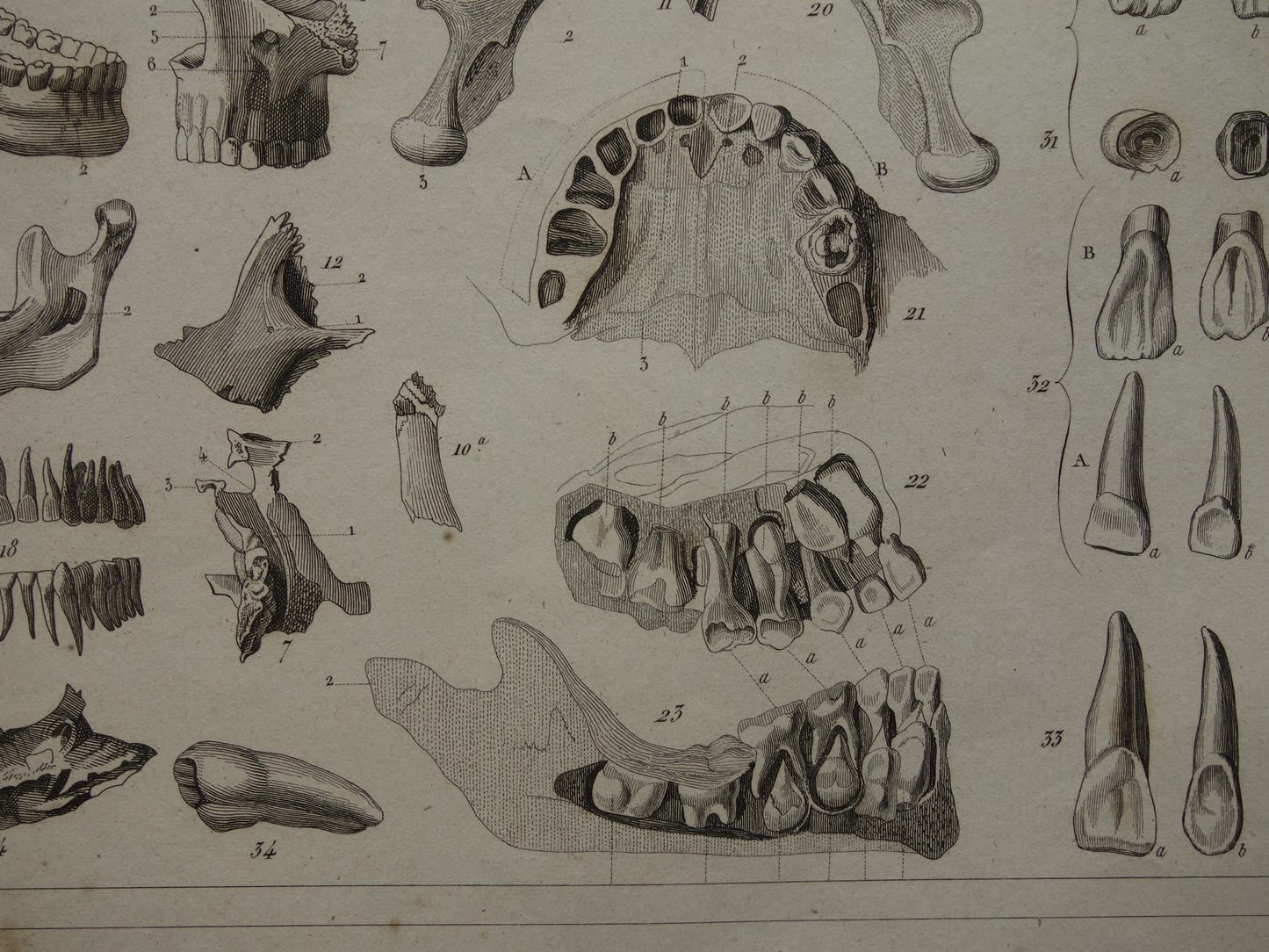 TANDEN oude anatomie print over Tand Kaak Gebit Antieke prent Vintage anatomische illustratie prent Kiezen Kaken