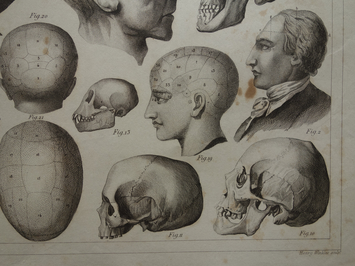 SCHEDEL Oude anatomie print over Schedels en Gezichtsmaskers Antieke prent Vintage anatomische illustratie Napoleon Kant