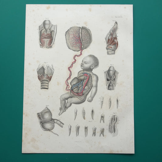 Oude anatomie print over foetale bloedsomloop 1871 Antieke prent tanden en kiezen Vintage anatomische illustratie