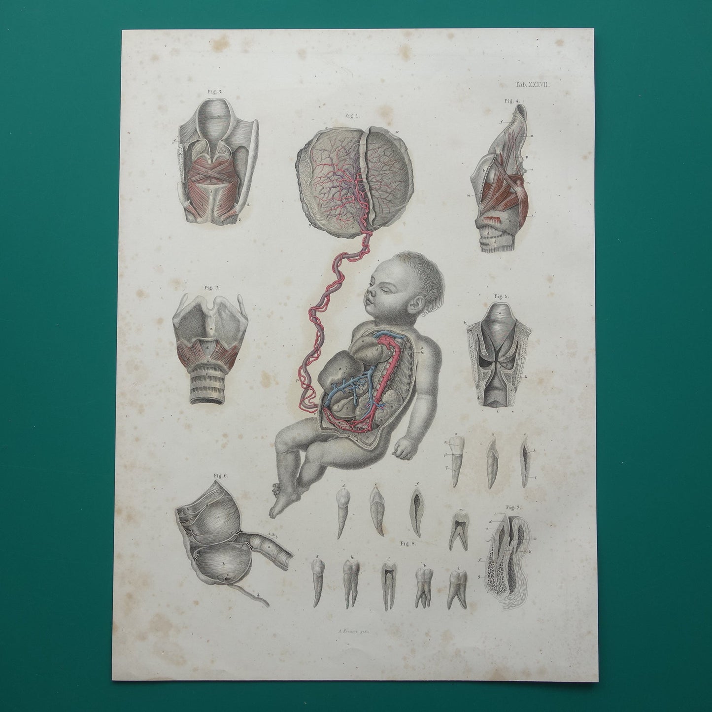 oude anatomische prenten kopen