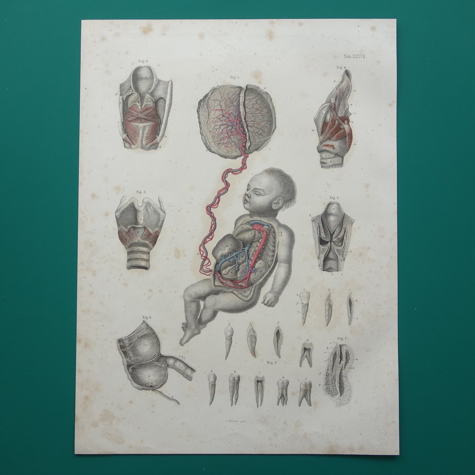 oude anatomische prenten kopen