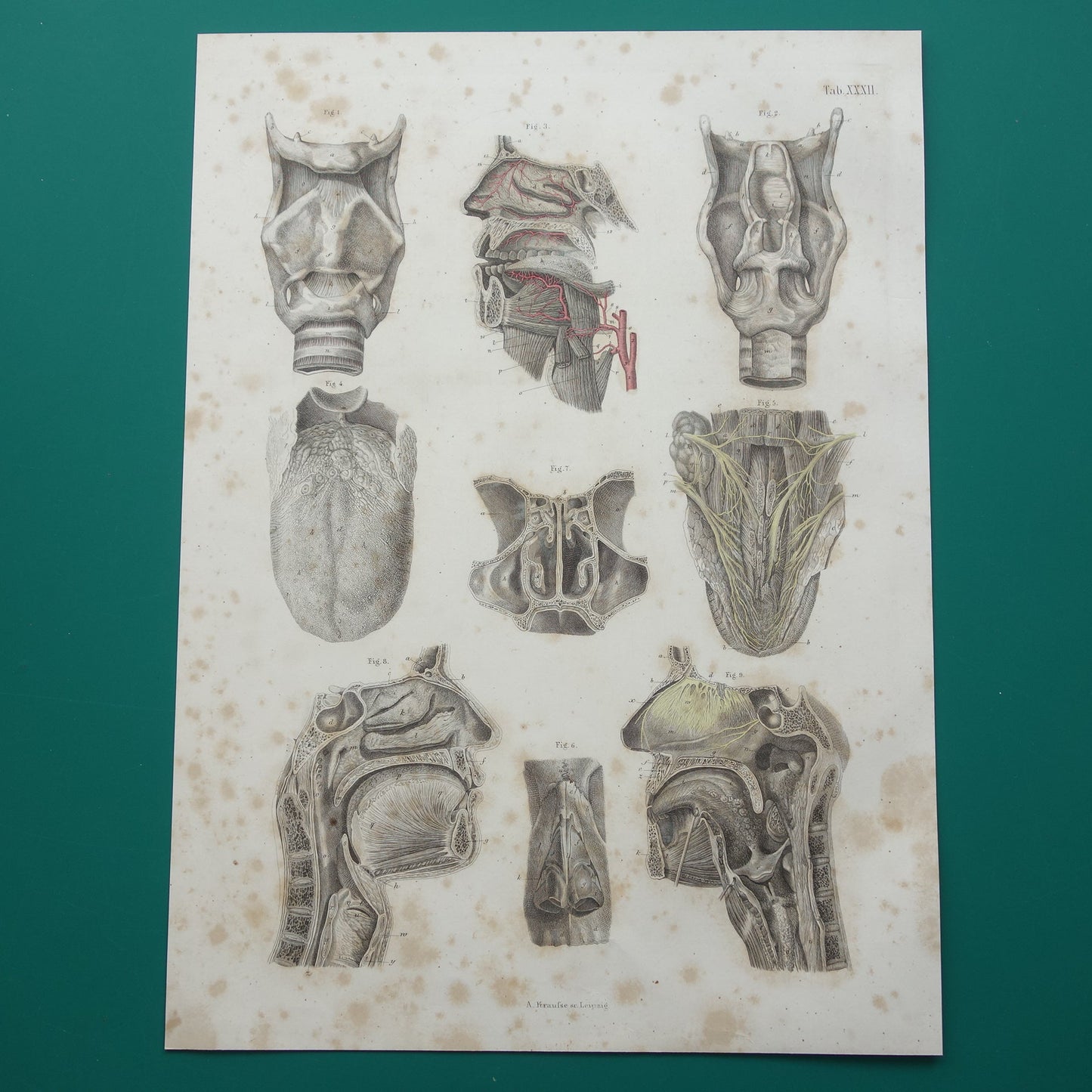 Oude anatomie print over neus keel tong 1871 Antieke prent Vintage anatomische illustratie