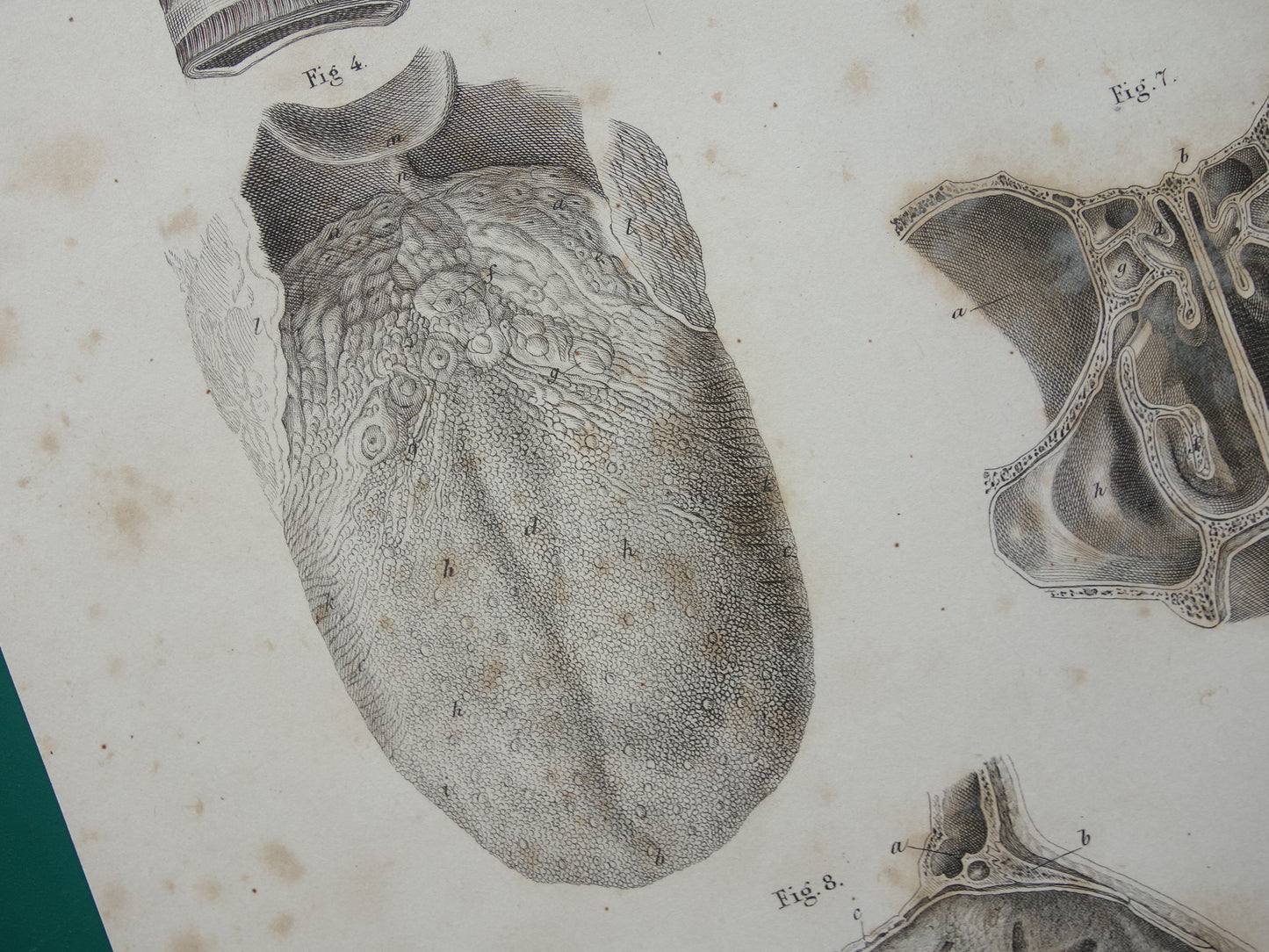 Oude anatomie print over neus keel tong 1871 Antieke prent Vintage anatomische illustratie