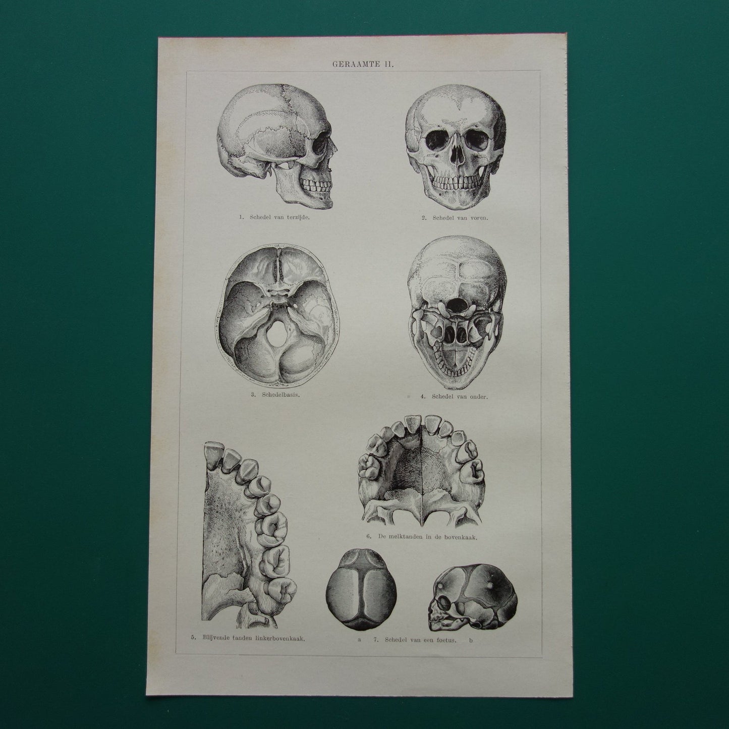 SKELET Oude anatomie prent uit 1928 Nederlandse originele vintage anatomische illustratie geraamte schedel vintage print