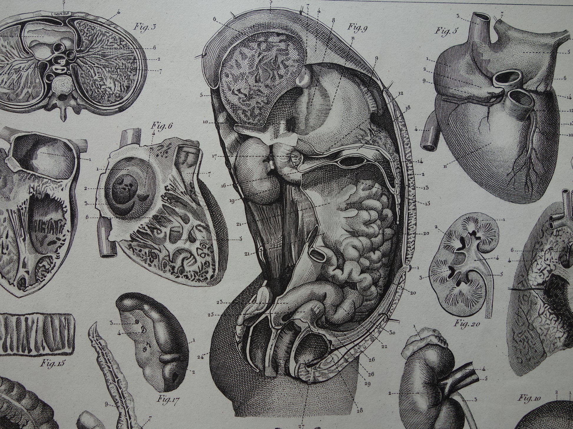 oude anatomie prenten kopen