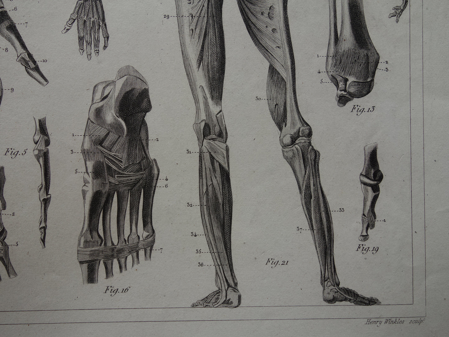 Antiker Anatomie-Druck, Skelett-Bänder und Muskeln des Menschen. Original 170+ Jahre alte Illustration, Vintage-Anatomische Drucke