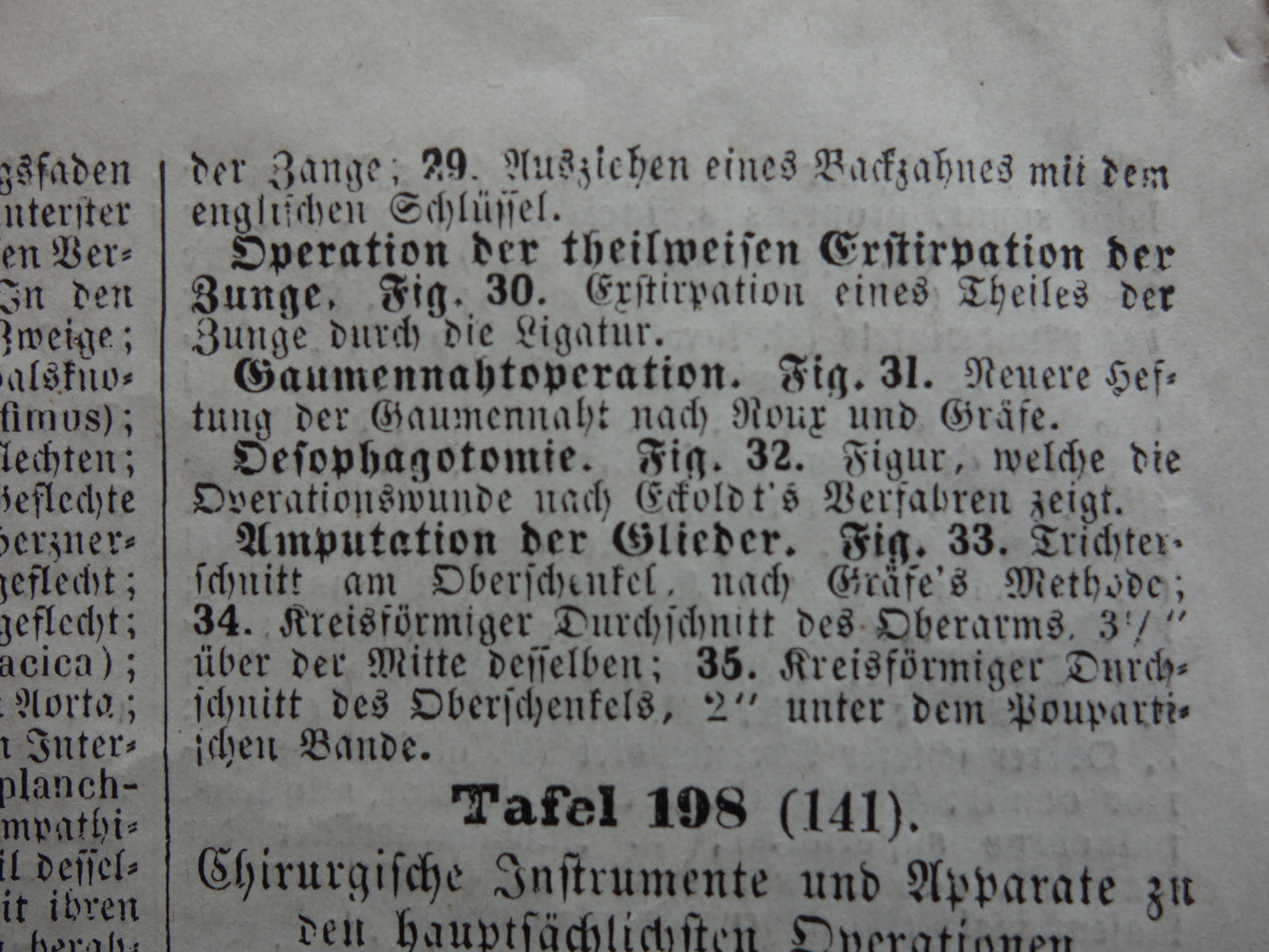Oude anatomie prent over chirurgie originele antieke print operaties instrumenten chirurg anatomische prenten