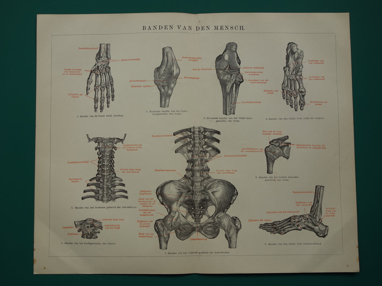 Oude Anatomie Prent Ligamanten Originele antieke anatomische illustratie vintage print van banden ligament gewrichtsbanden