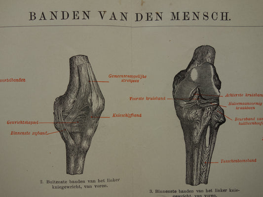 Old Anatomy Print Ligaments Original antique anatomical illustration vintage print of ligaments ligaments