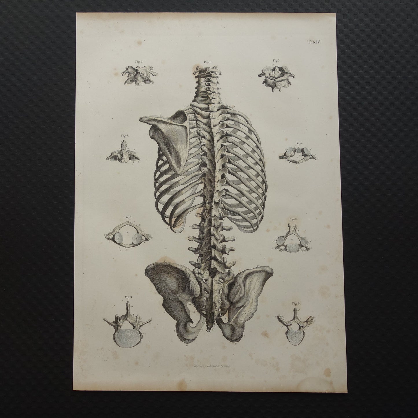 oude anatomische prenten kopen