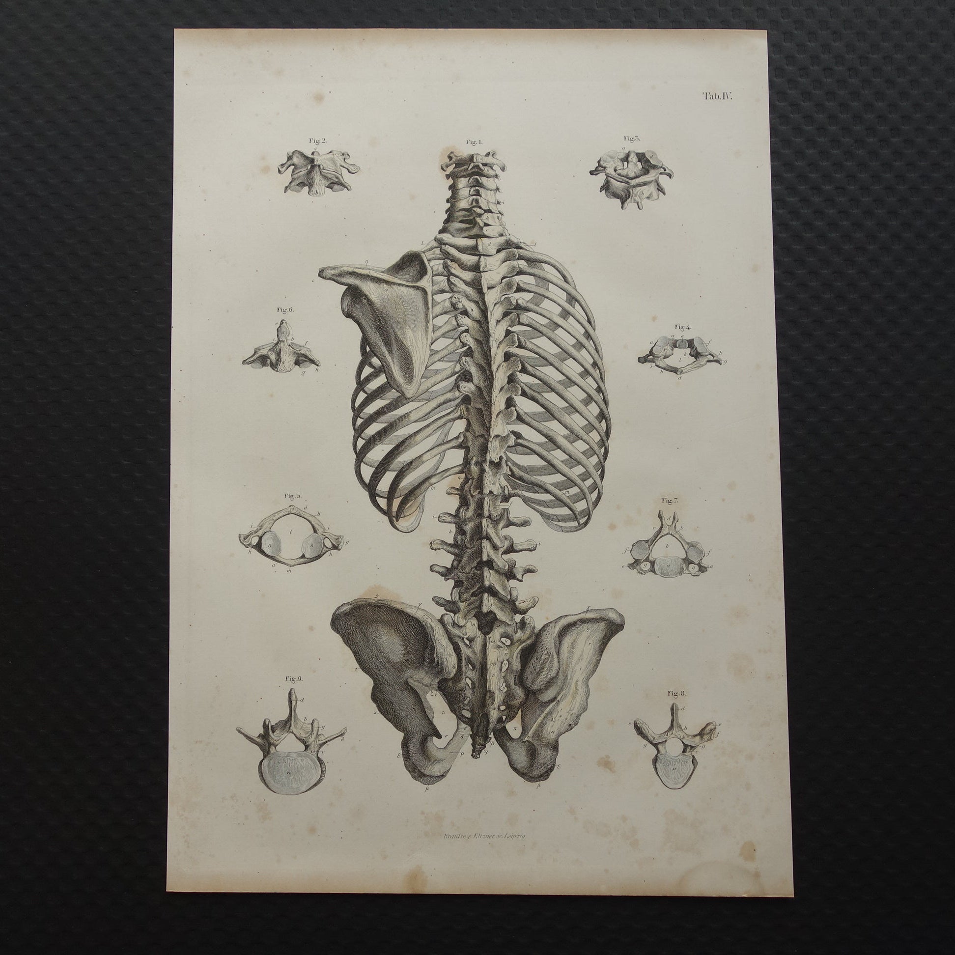 oude anatomische prenten kopen