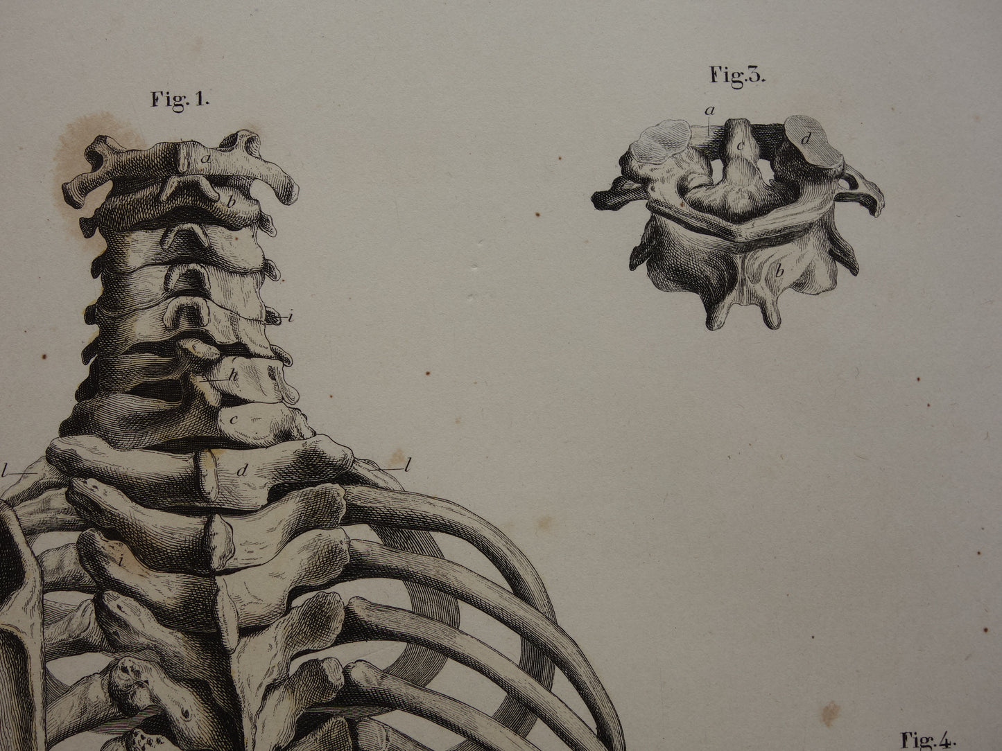 RIBBENKAST Oude anatomie print 1871 Antieke prent Bekken Vintage anatomische illustratie Wervels