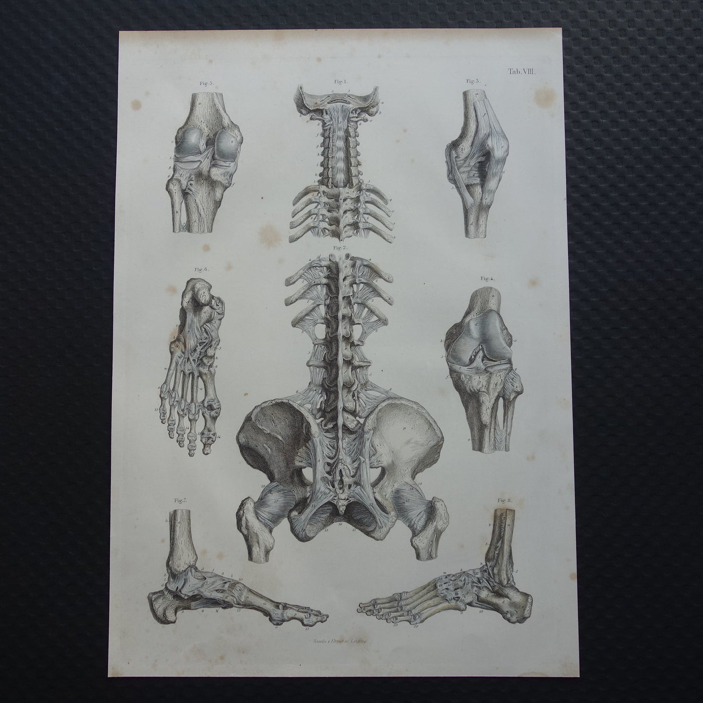 Oude anatomie print 1871 Antieke prent Nek Knie Voet Vintage anatomische illustratie Botten