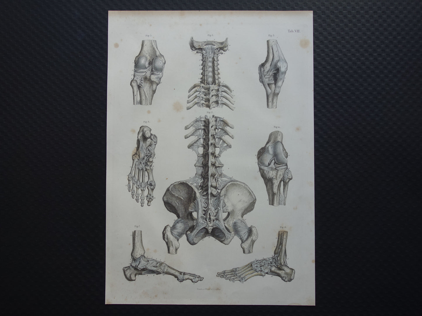 Oude anatomie print 1871 Antieke prent Nek Knie Voet Vintage anatomische illustratie Botten