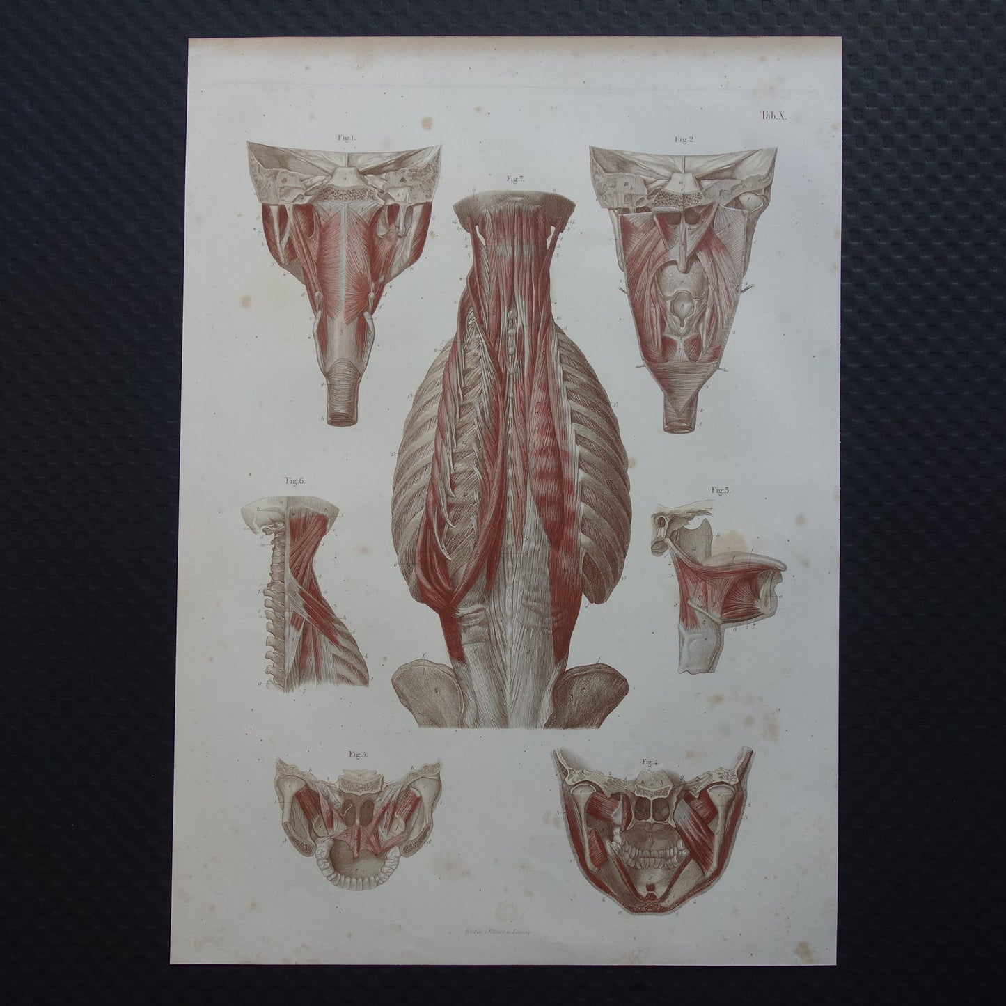 oude anatomie prenten kopen