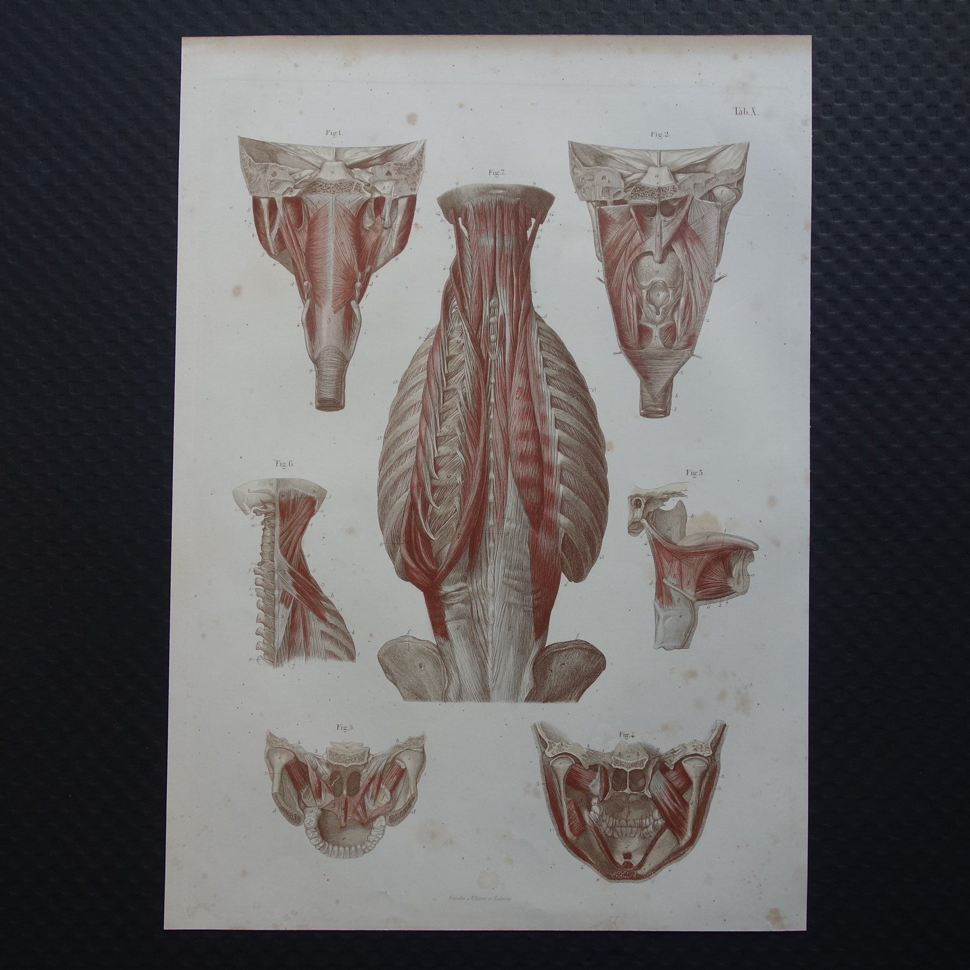 oude anatomie prenten kopen