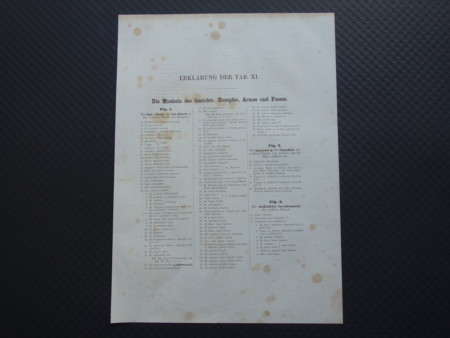 Spieren Oude anatomie print 1871 Torso Voet Voeten Antieke prent Vintage anatomische illustratie Spier