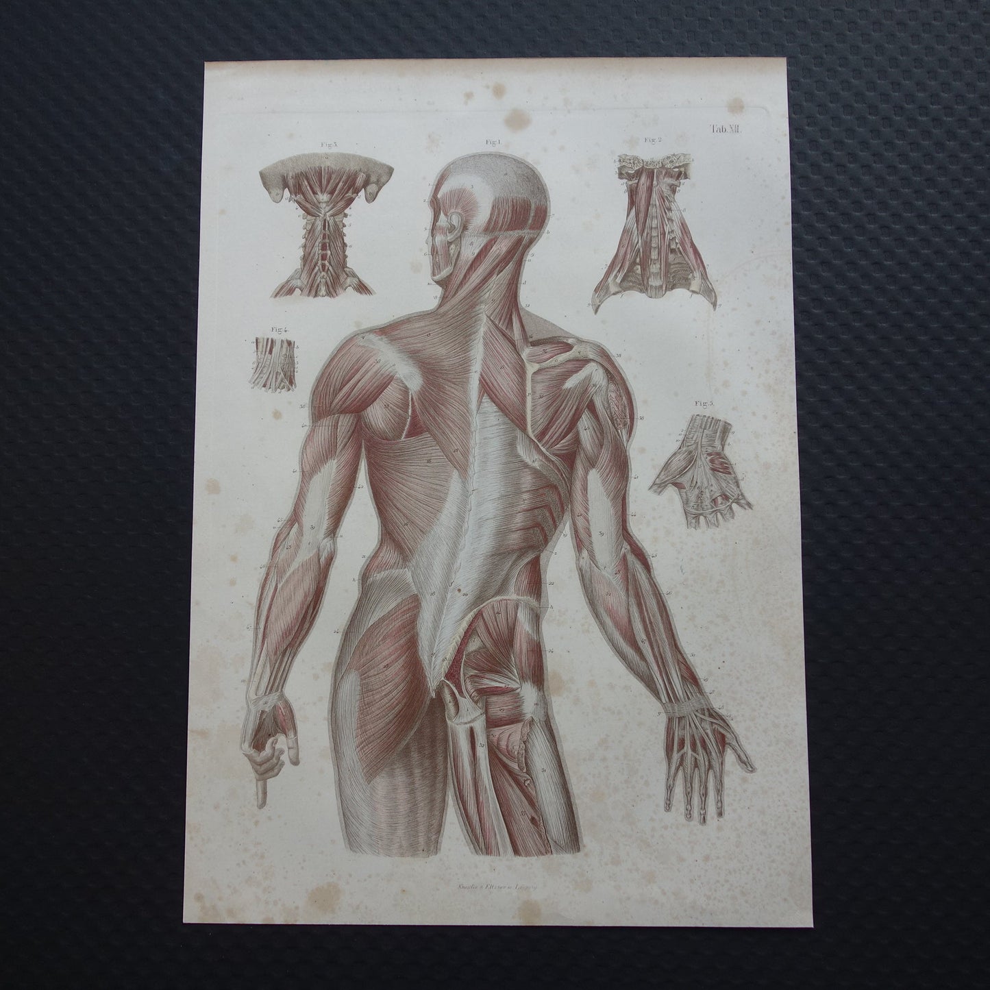 anatomie rugspieren vintage