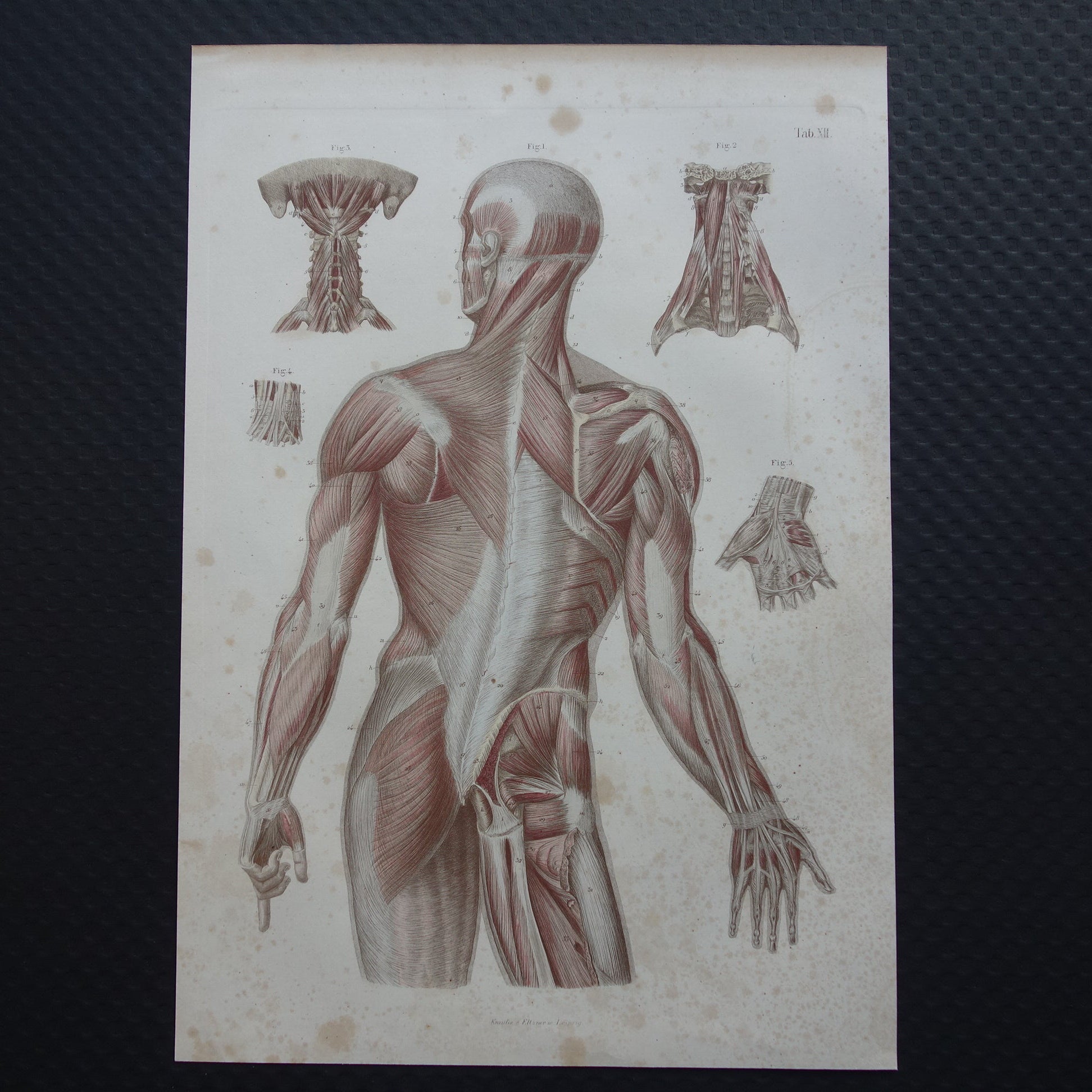 Antieke anatomie print spieren rug 1871 Torso Nek Antieke prent Vintage anatomische illustratie rugspieren
