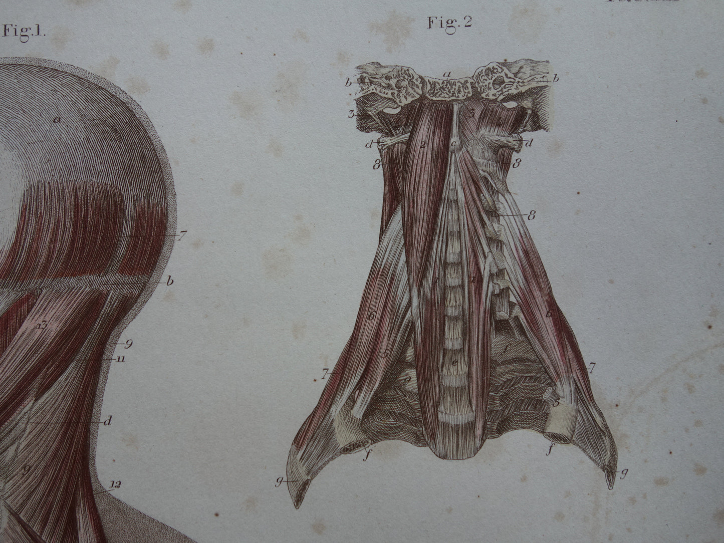 Antieke anatomie print spieren rug 1871 Torso Nek Antieke prent Vintage anatomische illustratie rugspieren