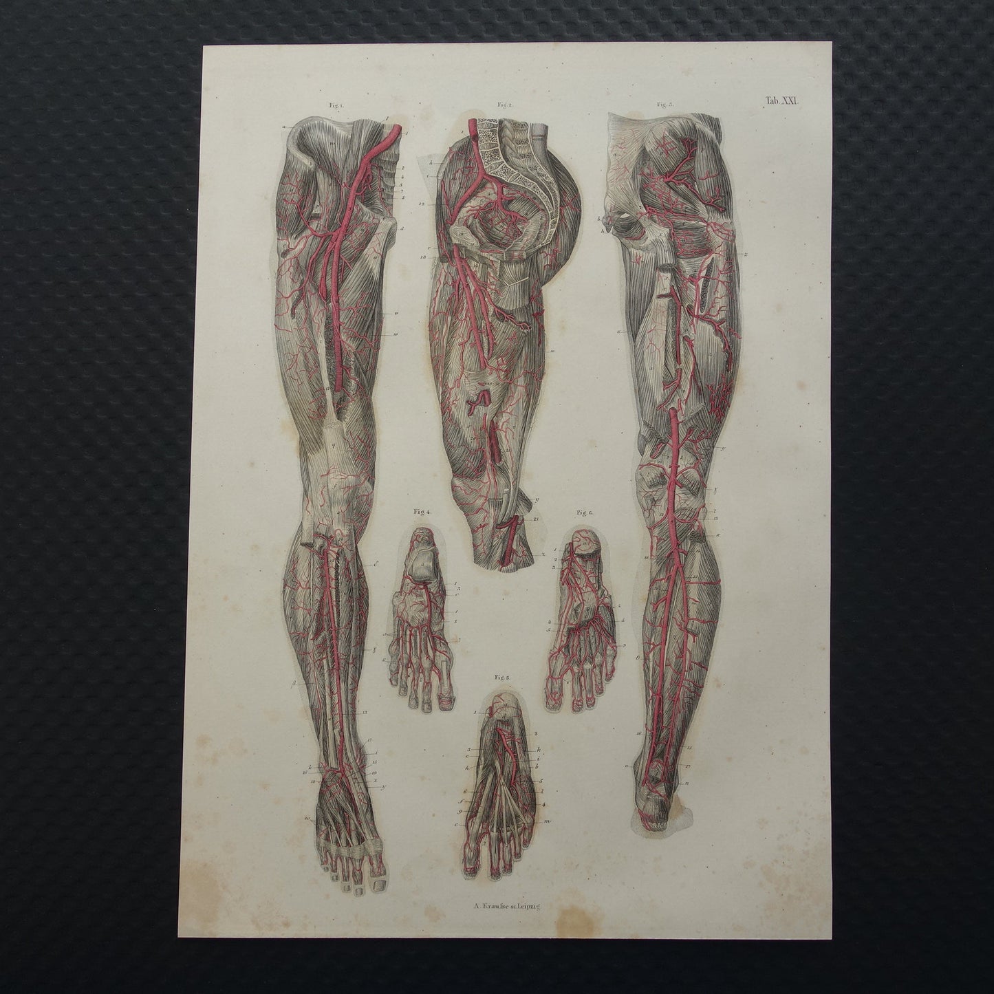 Oude anatomie print bloedvaten been voet 1871 Antieke prent slagaders benen voeten Vintage anatomische illustratie