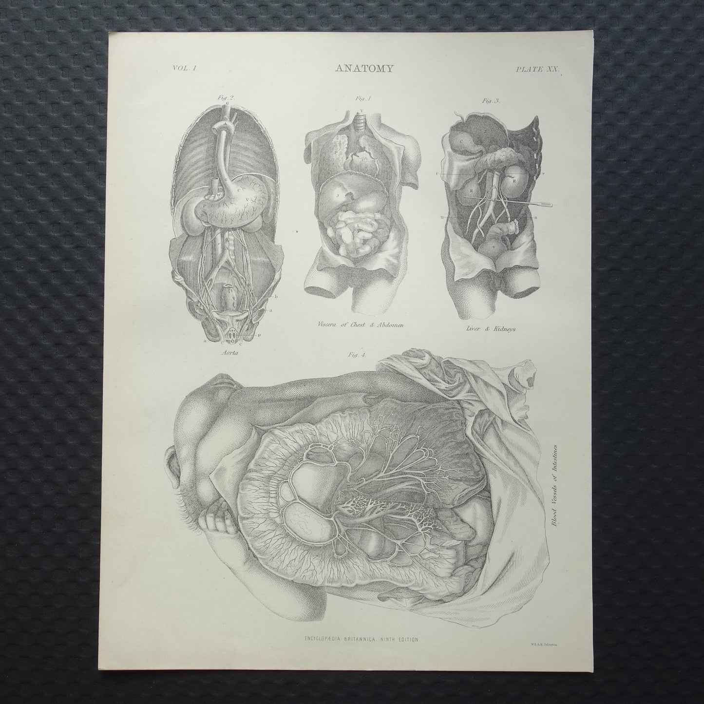 anatomische prenten kopen origineel antiek