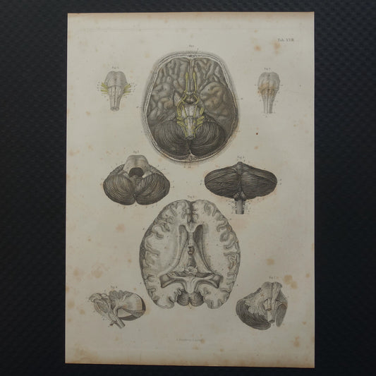 HERSENEN Oude anatomie print menselijke hersenen 1871 Antieke prent Vintage anatomische illustratie