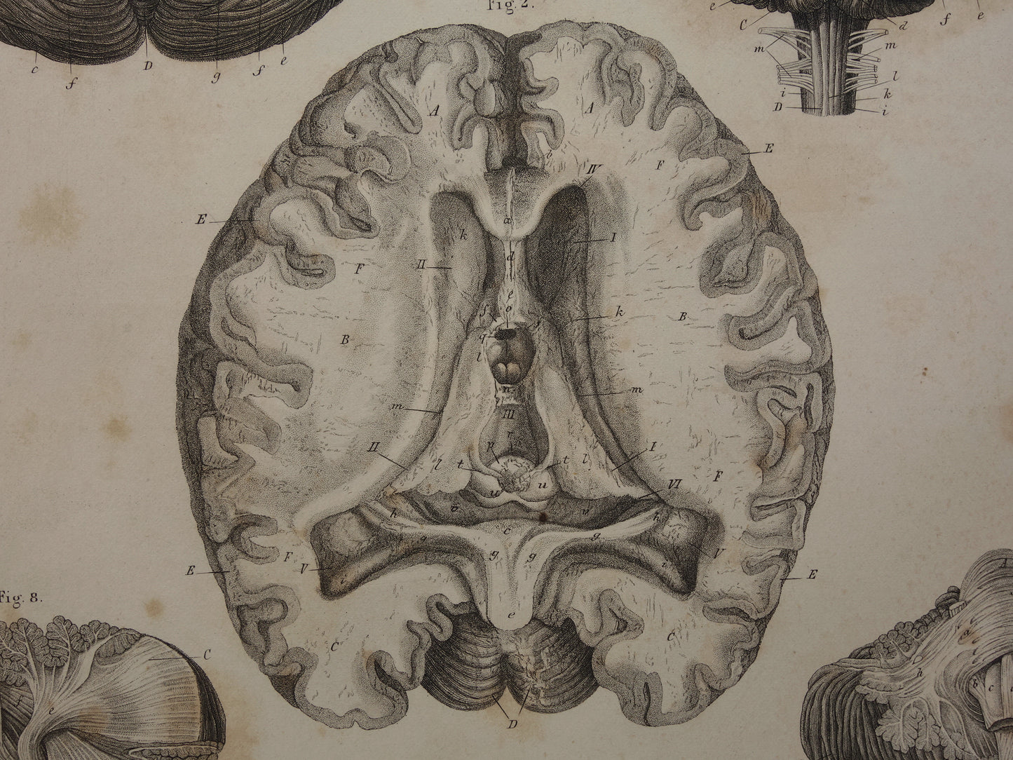 HERSENEN Oude anatomie print menselijke hersenen 1871 Antieke prent Vintage anatomische illustratie