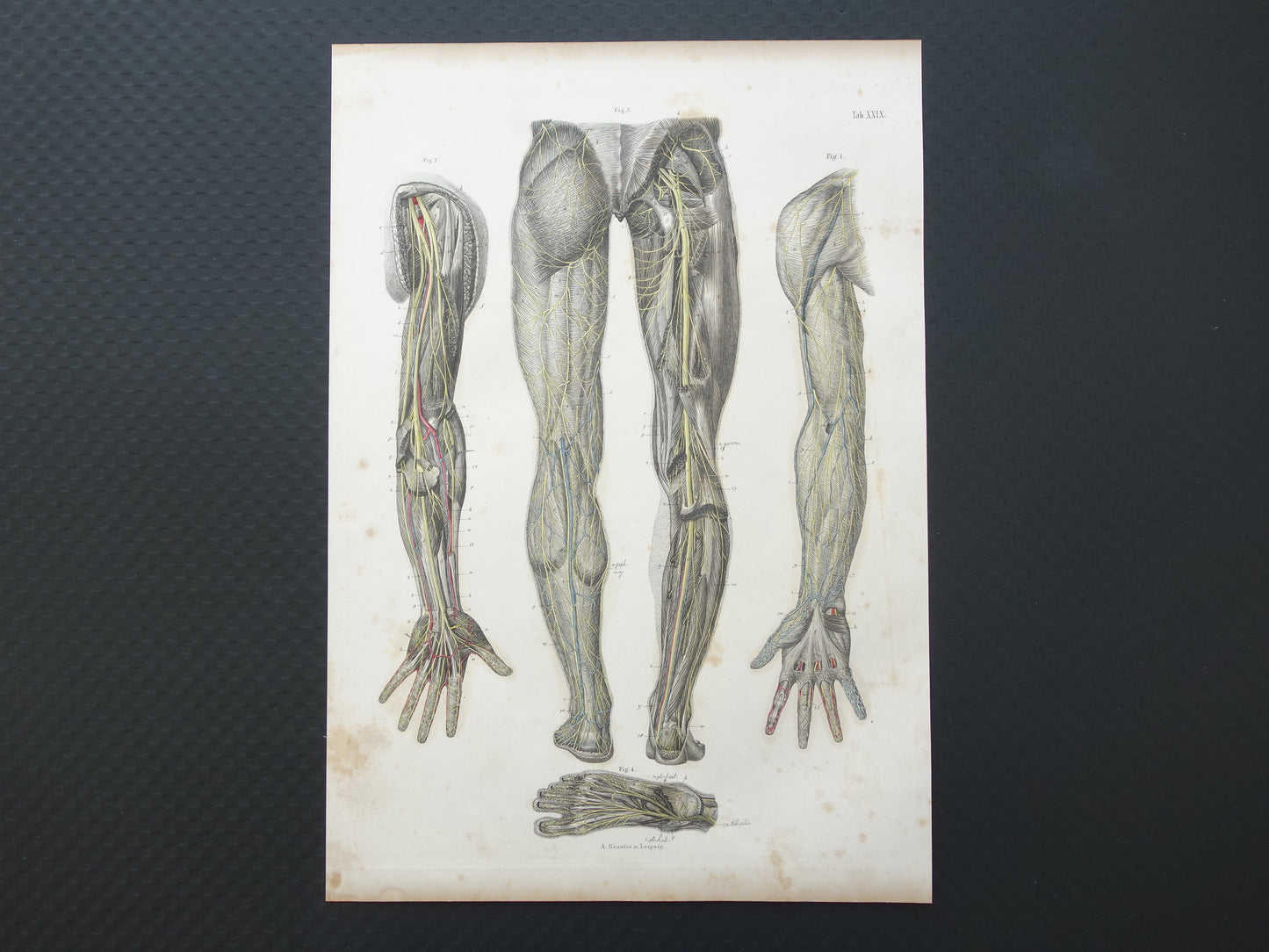 Oude anatomie print zenuwen in arm been 1871 Antieke prent Vintage anatomische illustratie zenuw armen benen