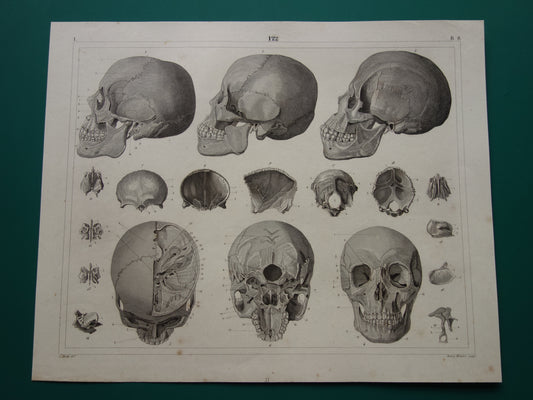 SCHEDELS oude anatomie print over Schedel Antieke prent Vintage anatomische illustratie prent