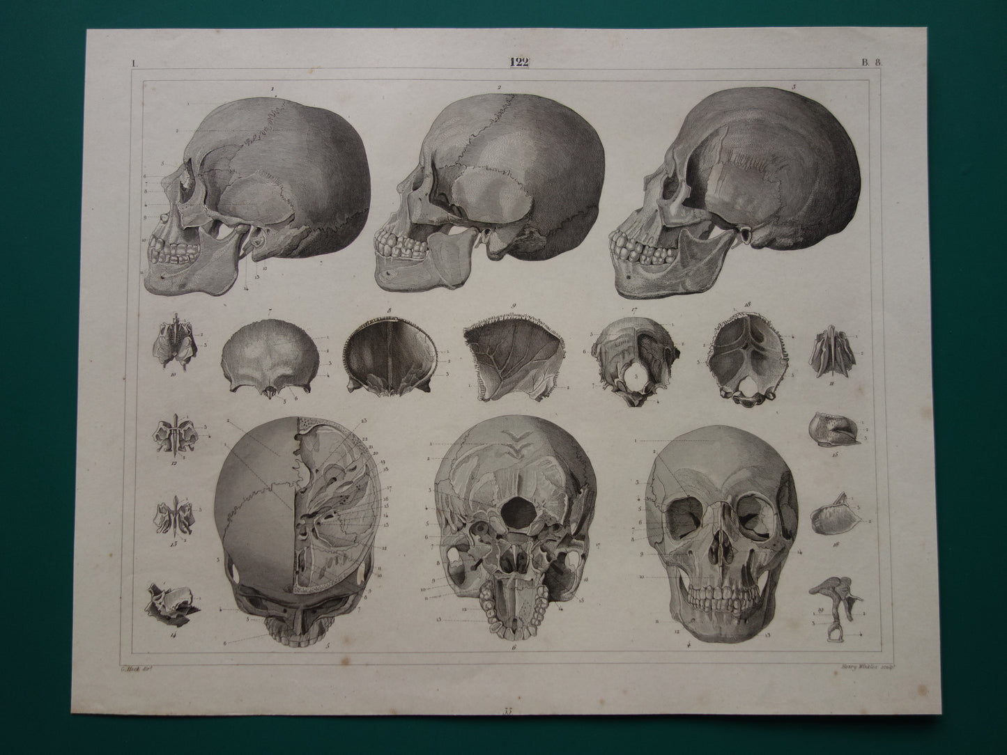 SCHEDELS oude anatomie print over Schedel Antieke prent Vintage anatomische illustratie prent