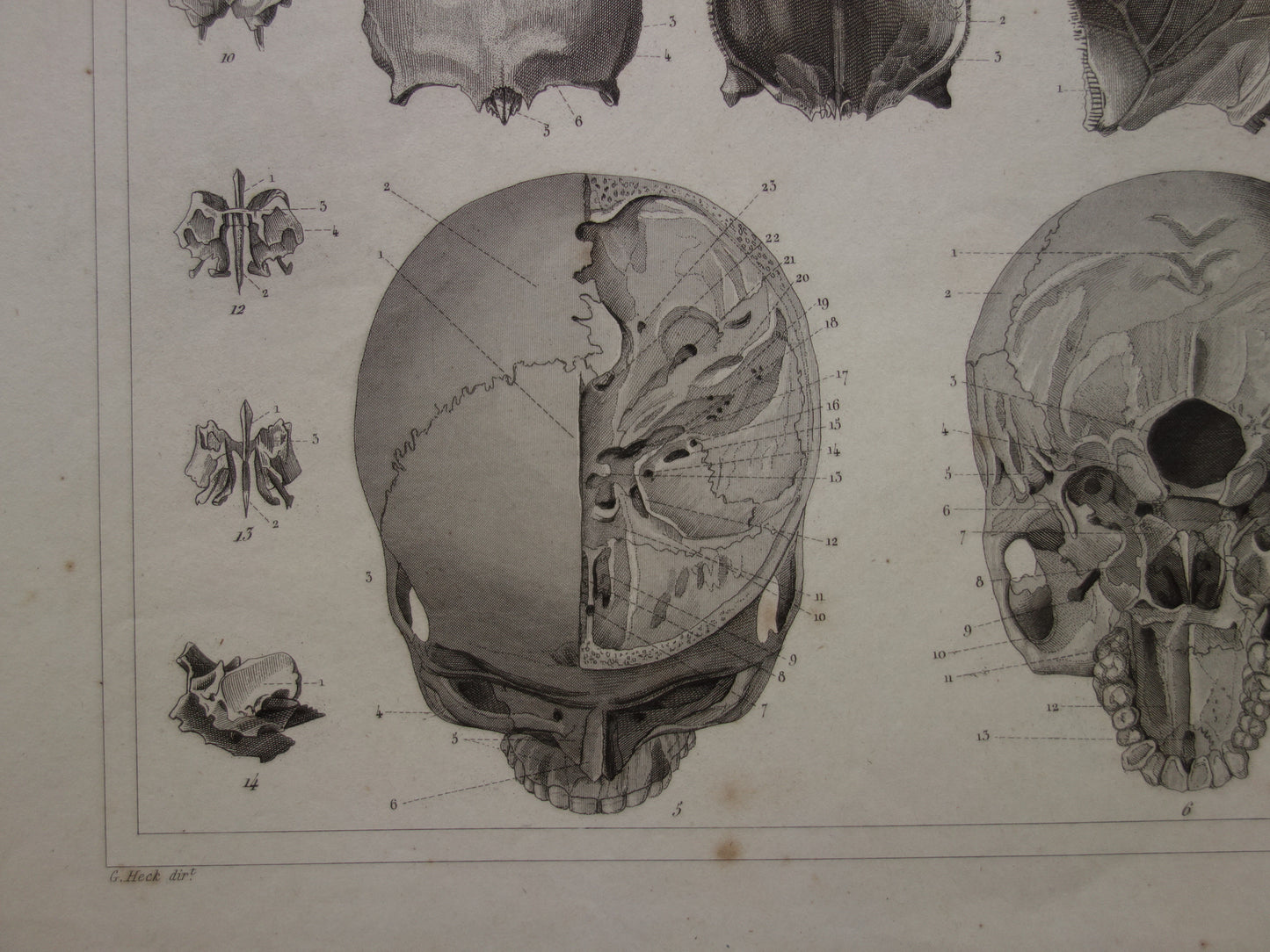 SCHÄDEL alter Anatomiedruck über Schädel. Antiker Druck. Vintage anatomischer Illustrationsdruck