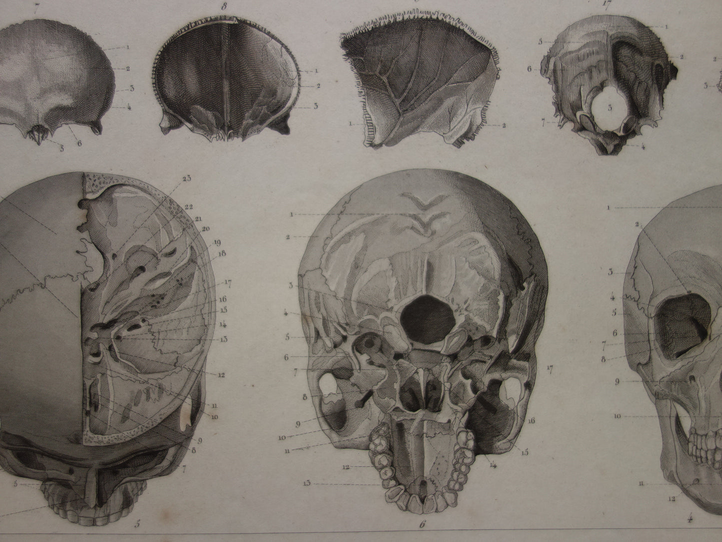 SCHÄDEL alter Anatomiedruck über Schädel. Antiker Druck. Vintage anatomischer Illustrationsdruck