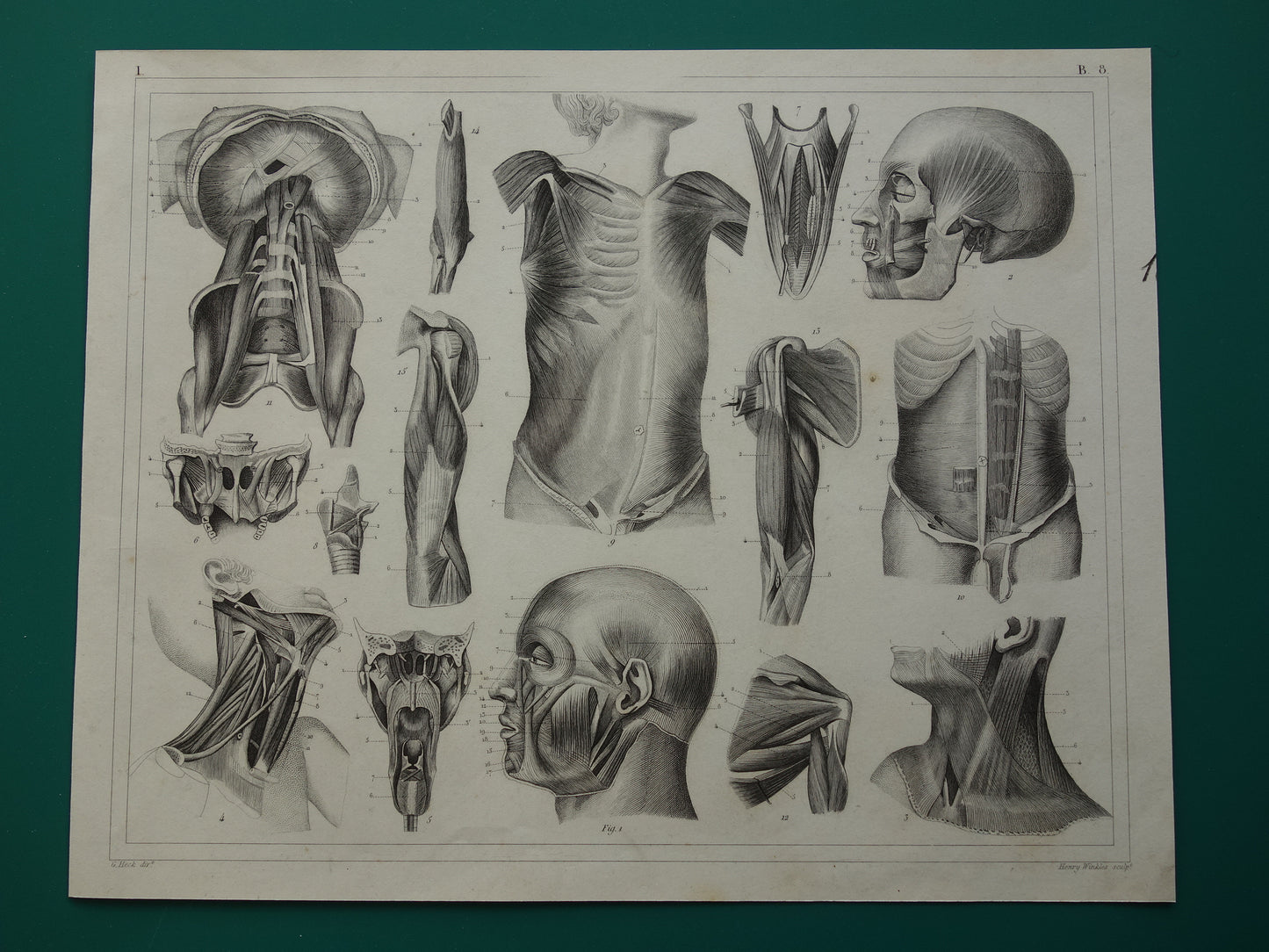Spieren van hoofd en nek oude anatomie prent Originele antieke anatomische illustratie schouderspieren hals