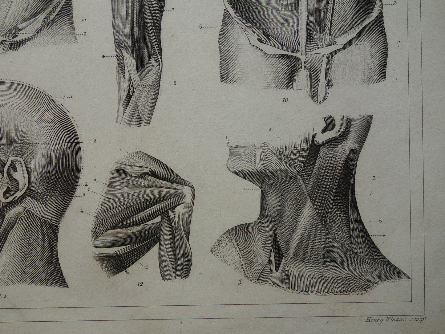 Spieren van hoofd en nek oude anatomie prent Originele antieke anatomische illustratie schouderspieren hals